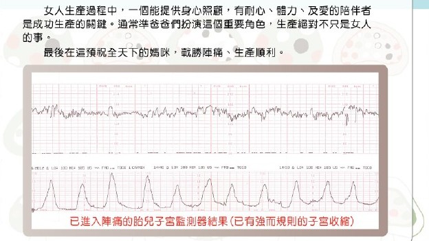 『產科』如何區分真假陣痛